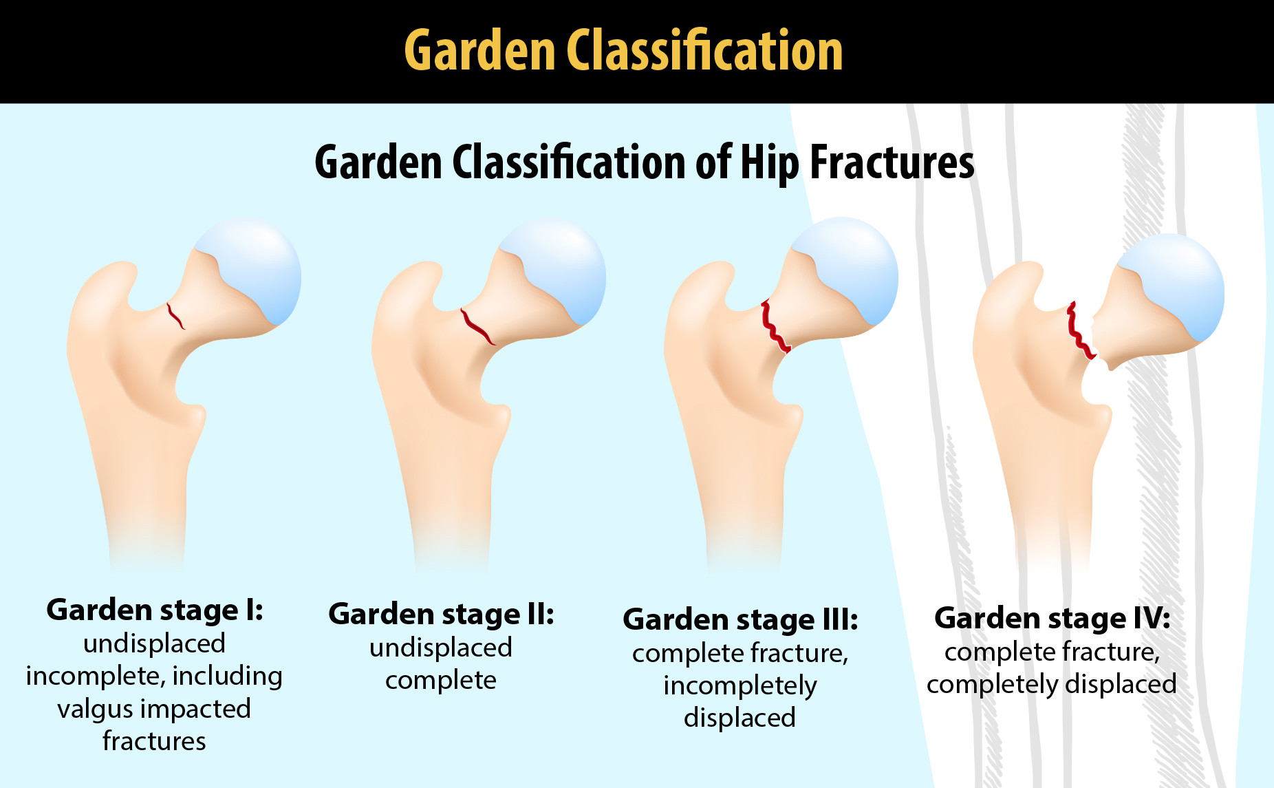 Garden Classification Diagram