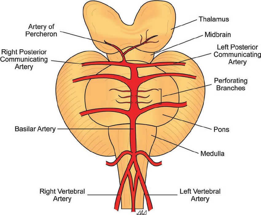 Artery of Percheron Image 1