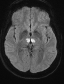 MRI Case 1a