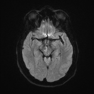 MRI Case 1b