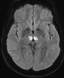 MRI Case 1c