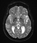 MRI Case 1d