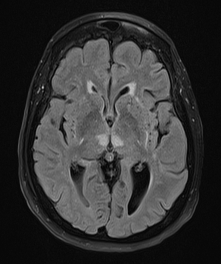 MRI Case 1e