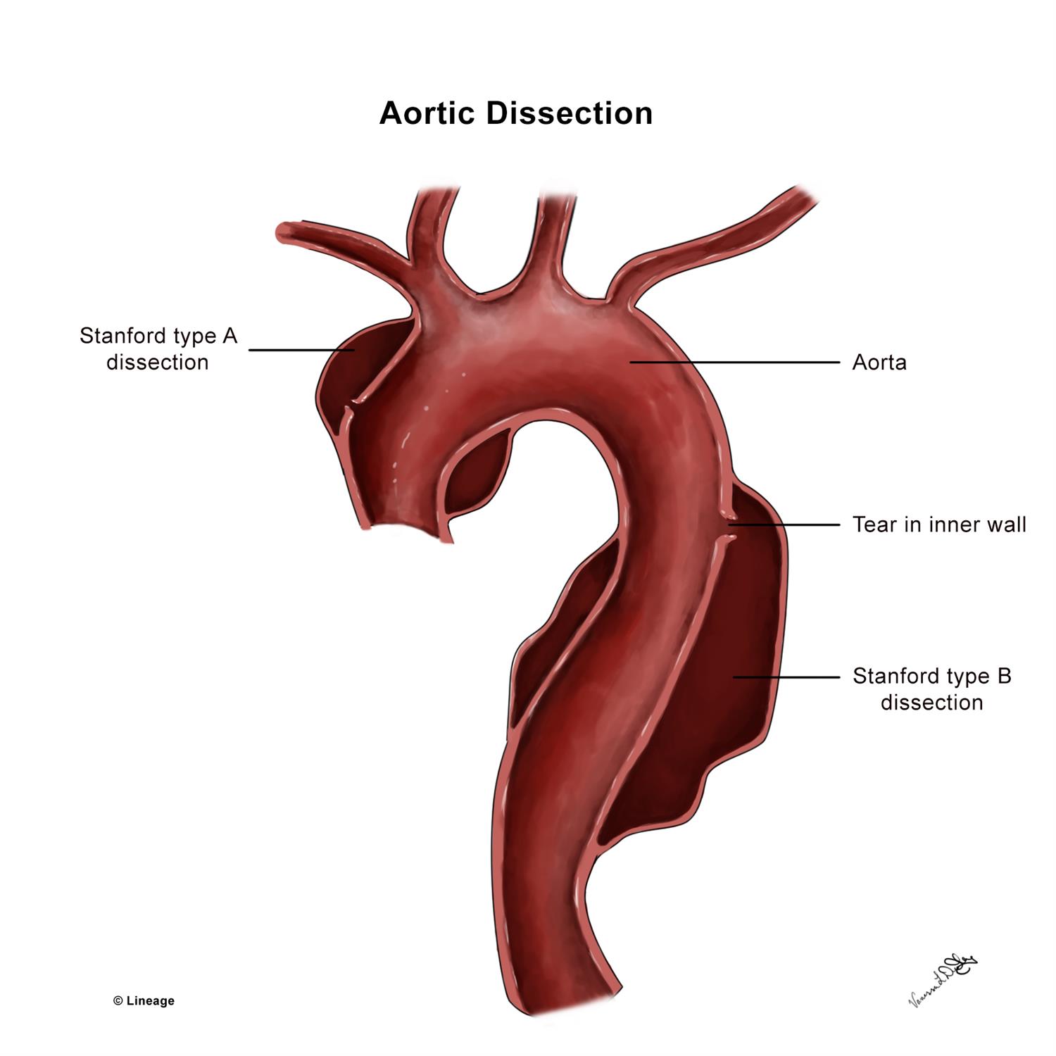 Aortic Anatomy