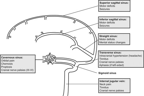 Venous Anatomy Image 3