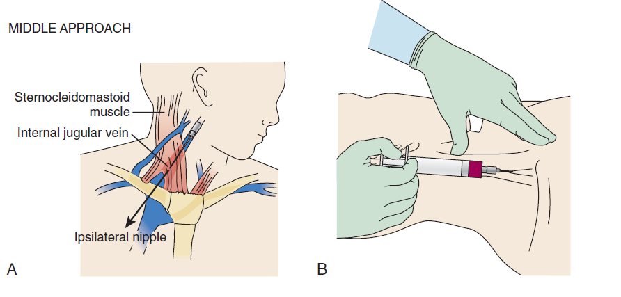 Internal Jugular Vein anatomy