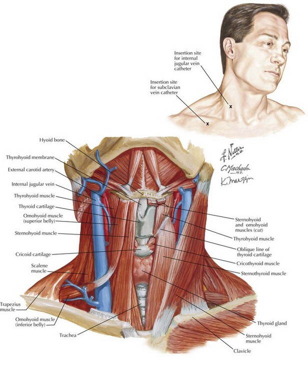 Internal Jugular Vein insertion technique