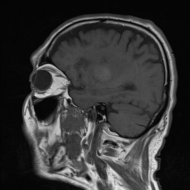 T1 Sagittal Example