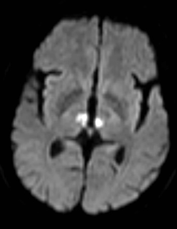 MRI Case 1f