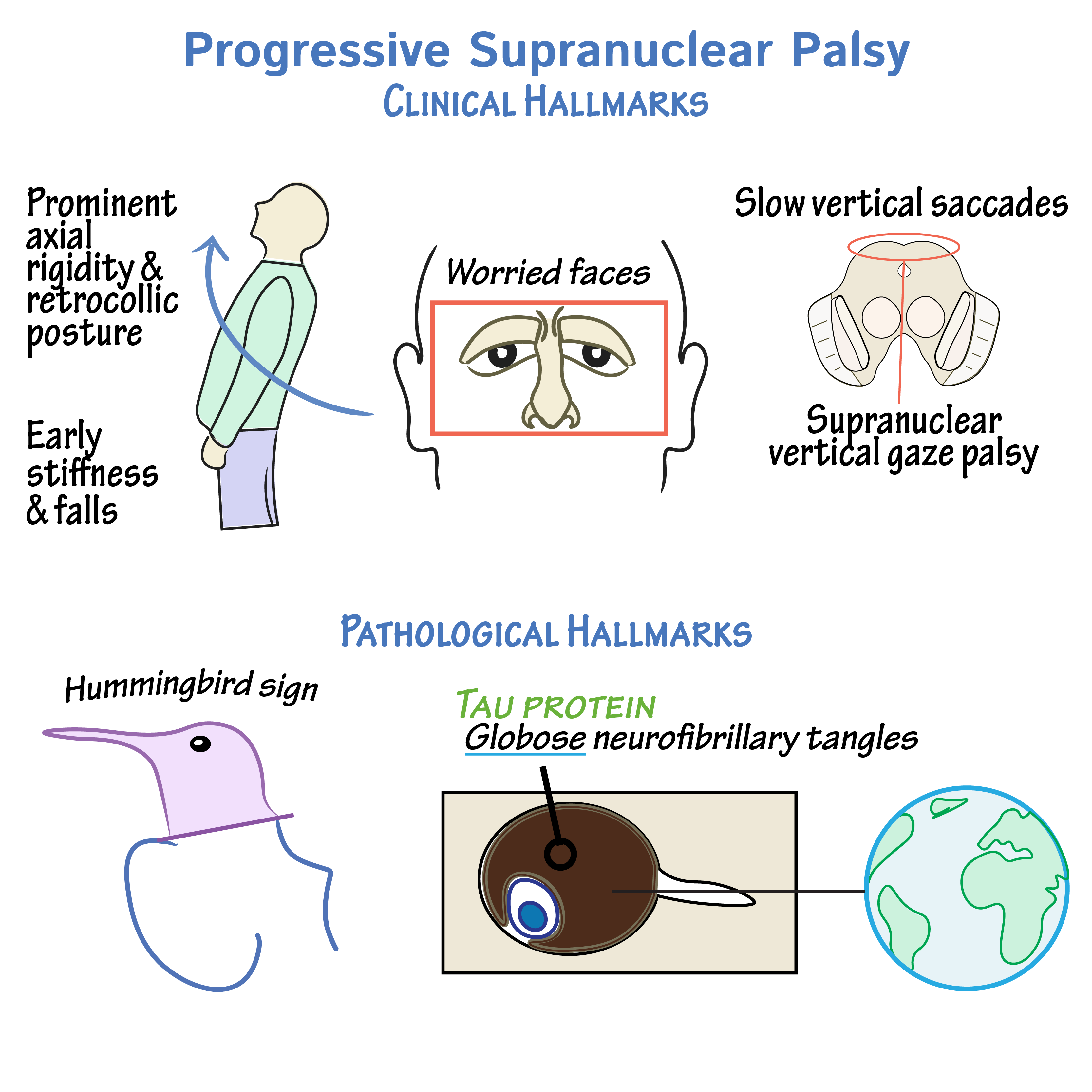 MRI Imaging in PSP