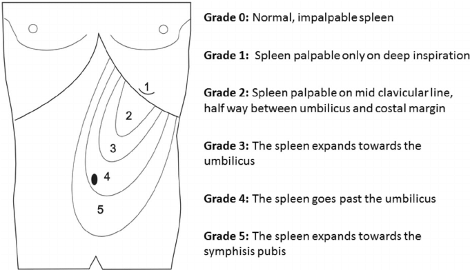 Spleen Examination