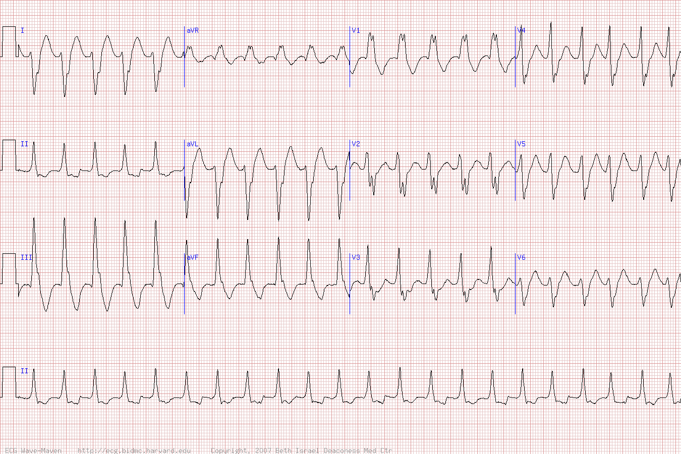 VT 106